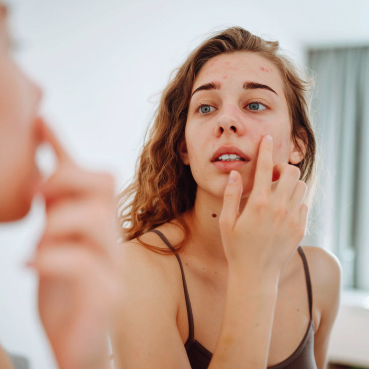 Tolerance⁺ Intense Restoring Serum | Soothing & Repairing
